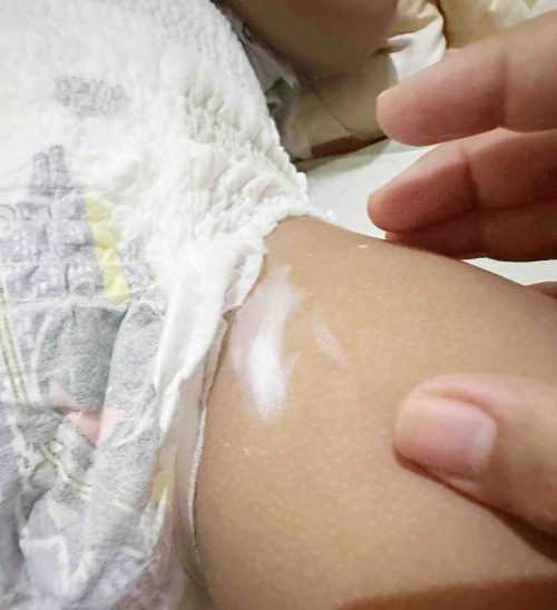 Mustela Barier Cream - Cara Mencegah dan Mengatasi Ruam Popok & Biang Keringat dengan Mustela