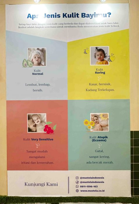 Apa Jenis Kulit Bayimu Mustela Indonesia