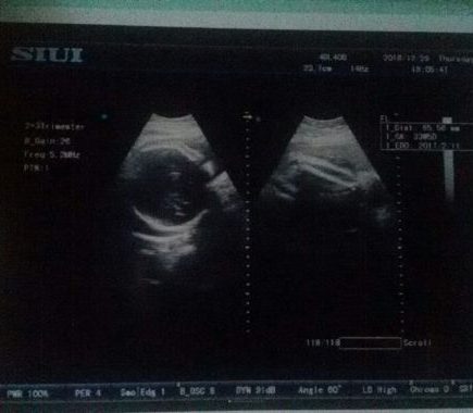 My Pregnancy Diary - Memasuki Trimester Ketiga