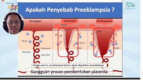 preeklampsia pada ibu hamil