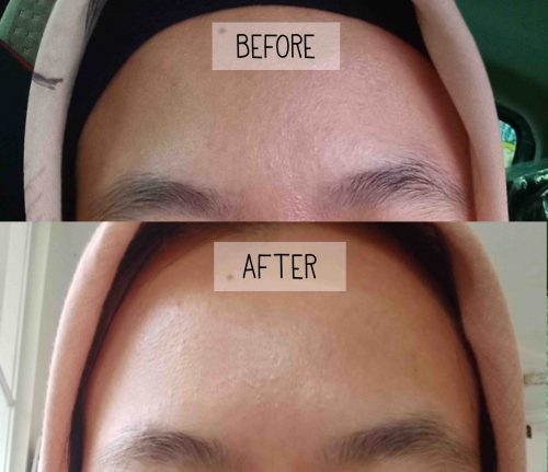 Before After pemakaian Avoskin Glow Concentrate Treatment untuk Anti Aging polypeptide multi probiome acetyl glucosamine red algae